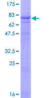 12.5% SDS-PAGE Stained with Coomassie Blue.